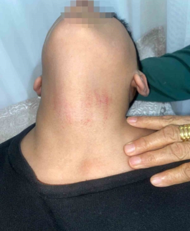 Küçükçekmece’de kadın memurun 10 yaşındaki öğrenciyi okulda darbettiği iddiası