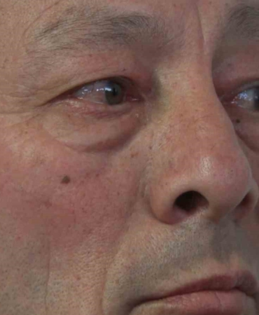 Ümraniye’deki ikinci cinayette acılı baba fenalaşarak hastaneye kaldırıldı