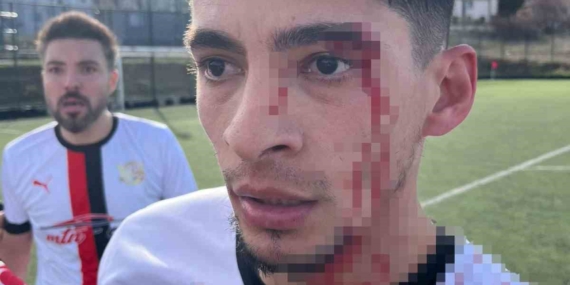 Maç sonrası saha içi savaş alanına döndü, 3 futbolcu hastanelik oldu