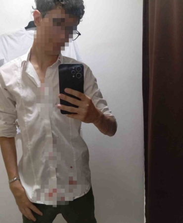 Küçükçekmece’de 16 yaşındaki çocuğu "fotoğraf çektin" iddiasıyla darbettiler