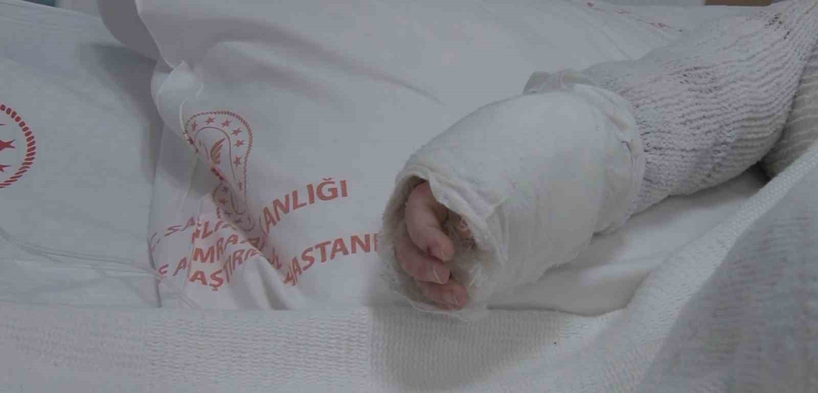 Üzerine kaynar su dökülen bebeğin vücudunun yüzde 27’si yandı