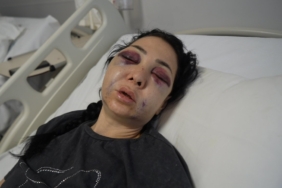 Anne ve oğlunun darp edilmesine ilişkin gözaltına alınan 3 şüpheliden 1’i tutuklandı