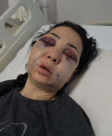 Anne ve oğlunun darp edilmesine ilişkin gözaltına alınan 3 şüpheliden 1’i tutuklandı