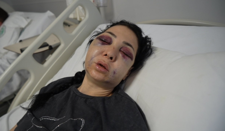 Anne ve oğlunun darp edilmesine ilişkin gözaltına alınan 3 şüpheliden 1’i tutuklandı