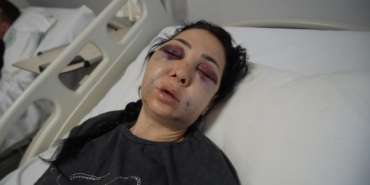 Oğlunun gözü önünde anneyi öldüresiye dövdüler: "’Küfür etmeyin’ dedik diye bu hale geldim"