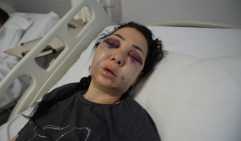 Oğlunun gözü önünde anneyi öldüresiye dövdüler: "’Küfür etmeyin’ dedik diye bu hale geldim"