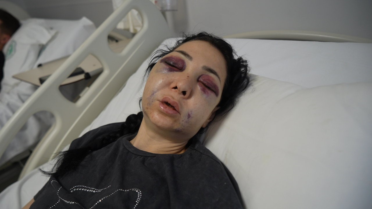 Oğlunun gözü önünde anneyi öldüresiye dövdüler: "’Küfür etmeyin’ dedik diye bu hale geldim"