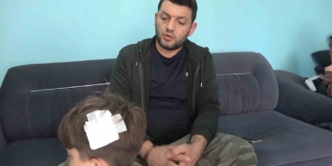 Yalova’daki komşu kavgasında bu kez 8 yaşındaki çocuğa taşlı saldırı