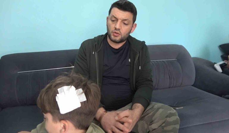 Yalova’daki komşu kavgasında bu kez 8 yaşındaki çocuğa taşlı saldırı