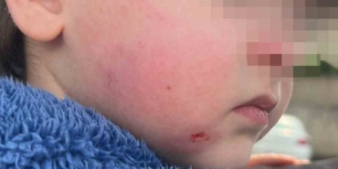 Kreşe bıraktığı çocuğunu darp edilmiş halde aldı