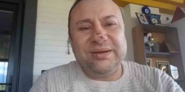 Pitbull saldırısına uğrayan Onur Akay o anları anlattı: "Ben ölümden döndüm"