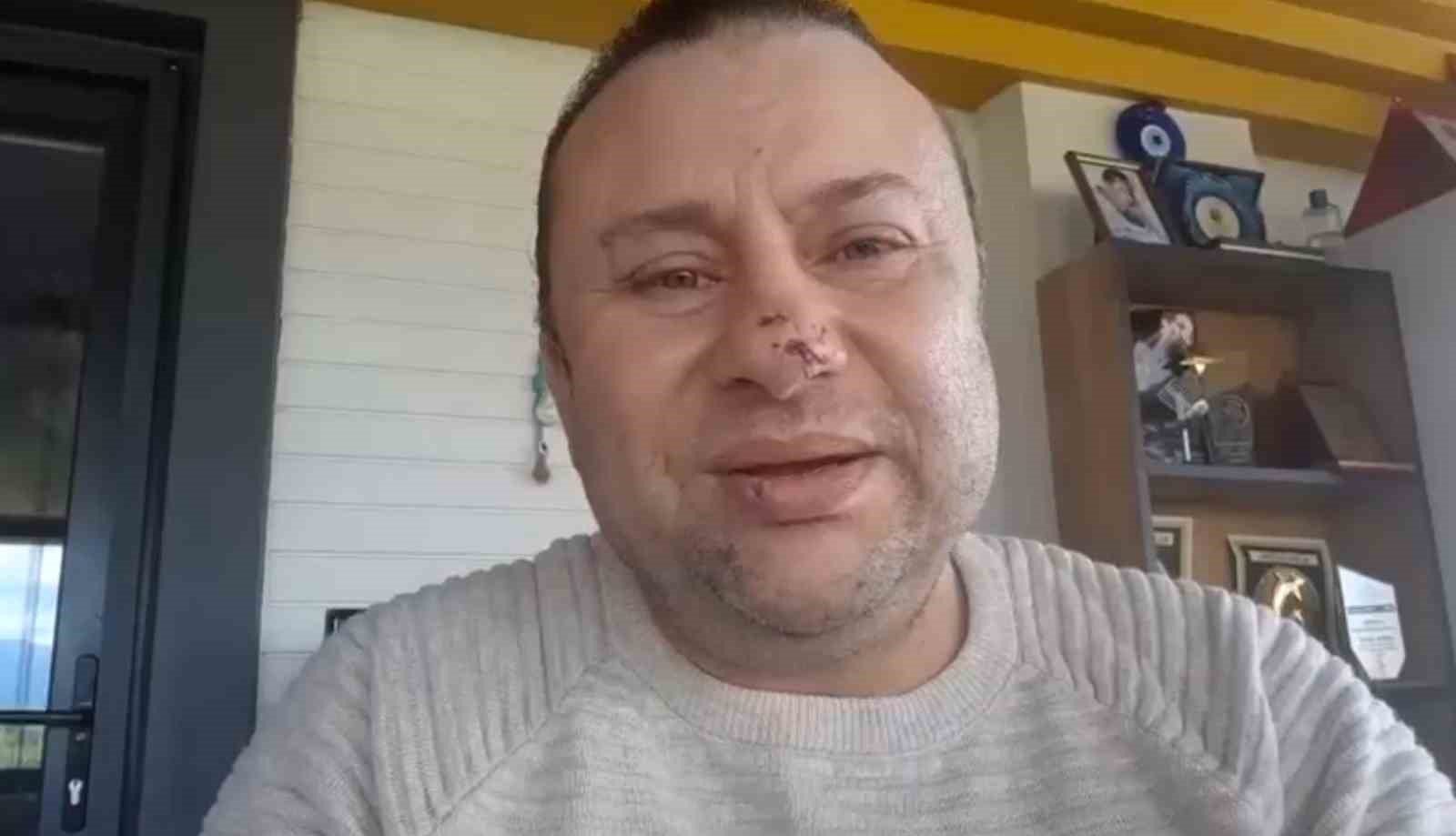 Pitbull saldırısına uğrayan Onur Akay o anları anlattı: "Ben ölümden döndüm"