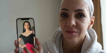 Feci şekilde darp edilmişti, yaşadığı dehşeti unutamıyor