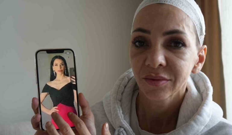 Feci şekilde darp edilmişti, yaşadığı dehşeti unutamıyor