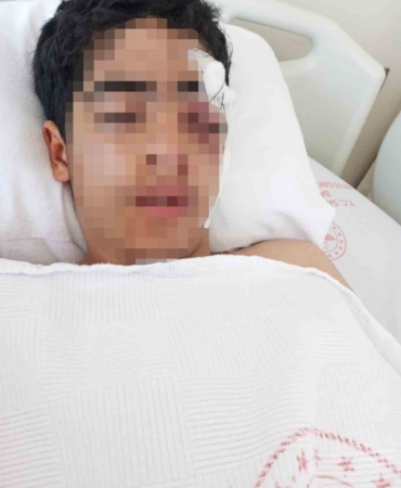 Akran zorbalığına bir yenisi eklendi: 15 yaşındaki çocuk muştayla öldüresiye dövüldü